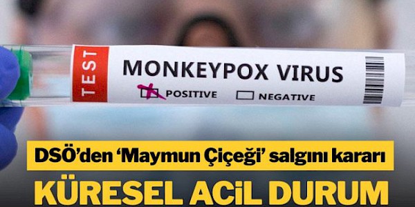 DSÖ, Maymun çiçeği virüsü için ‘küresel acil durum’ ilan etti.