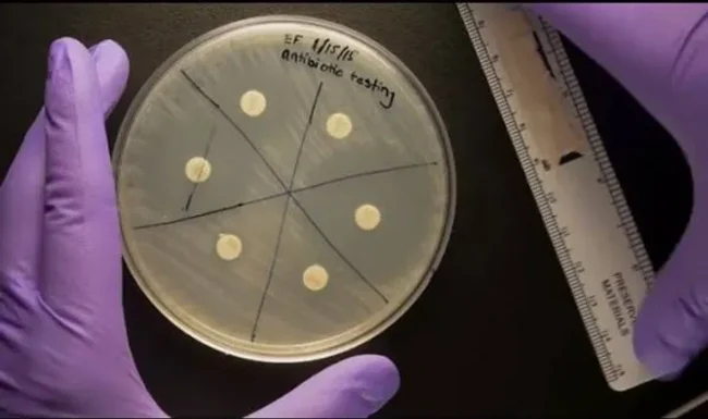 Antibiyotik Duyarlılık Testi